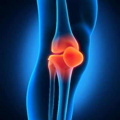 A/Prof Nigel Hope | Hip and Knee Surgeon Sydney | Knee Pain